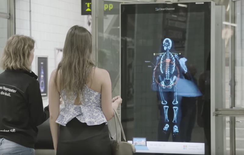 Surface Pro 4 Real Time Posture Scanner