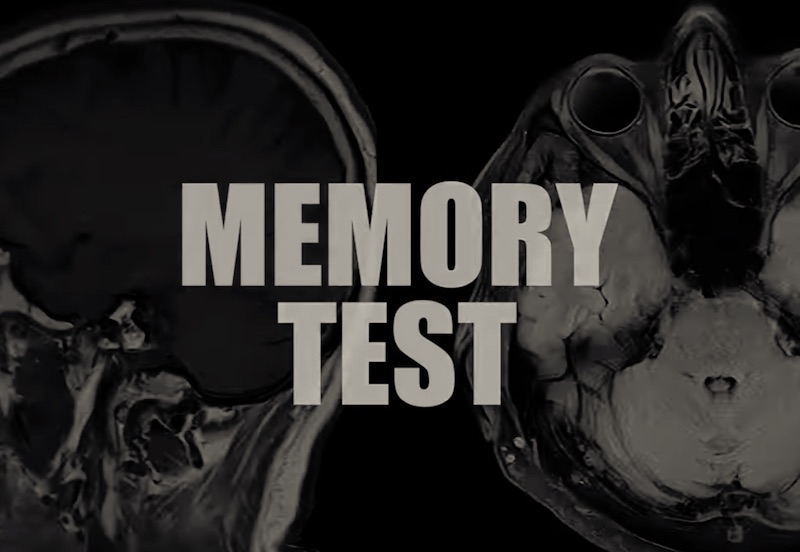 Supradyn Memory Test